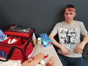 Uczestnik spotkania prezentuje rany, które można odnieść w wypadku.